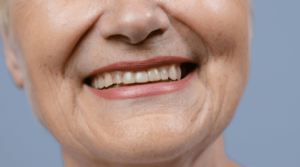 woman with dental implants smiling at High St Dental Care