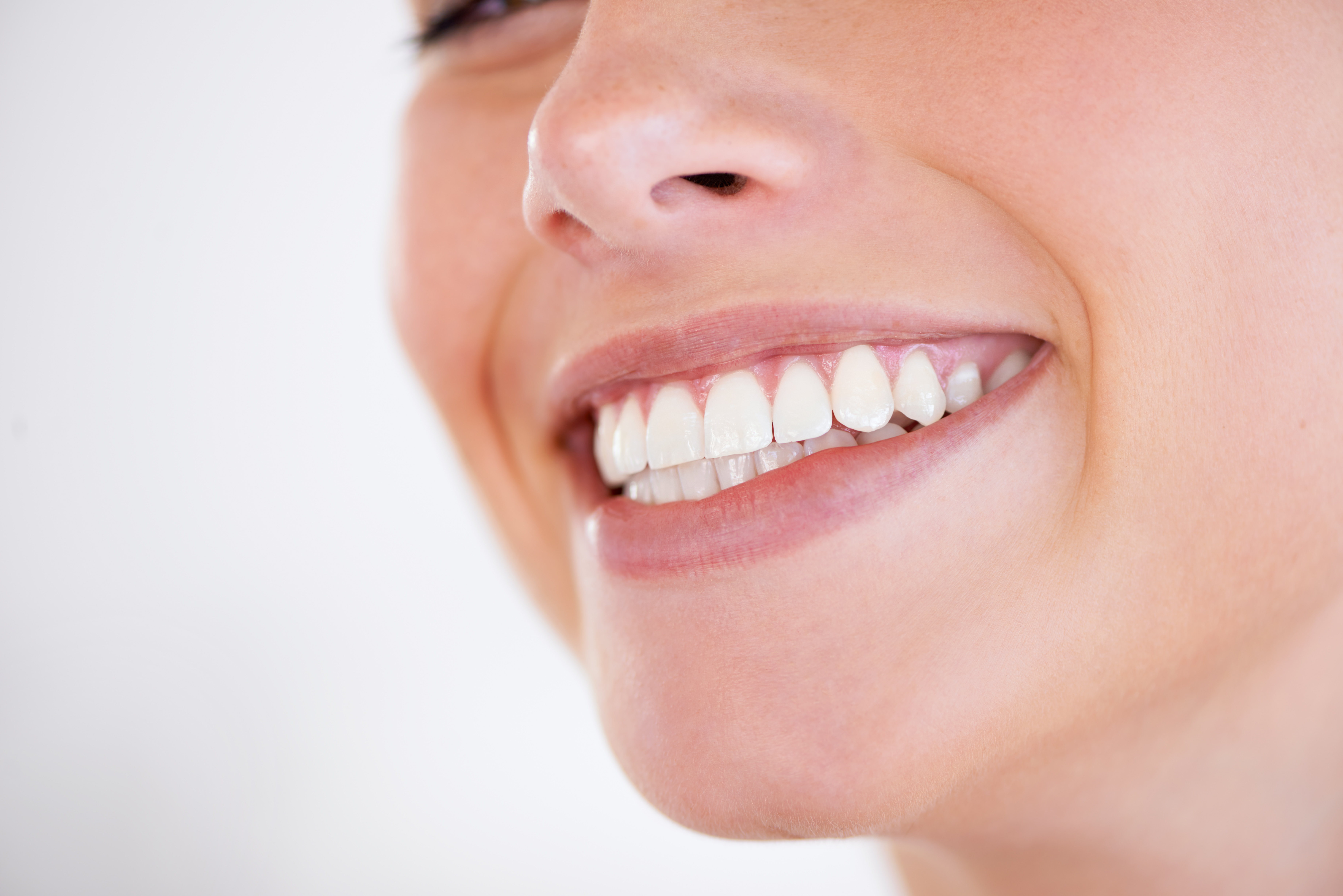 A women smiling after teeth whitening treatment