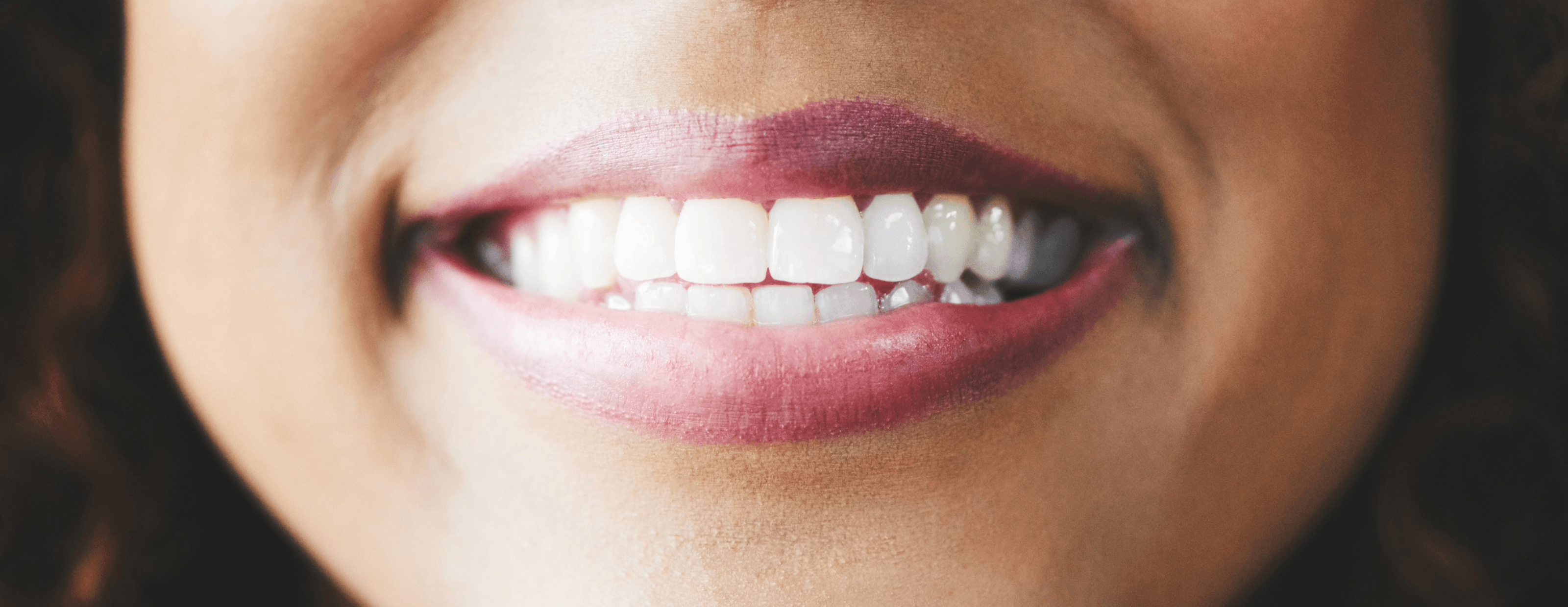 Woman smiling after teeth whitening